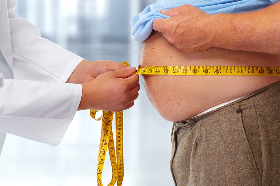 COVID 19 Y OBESIDAD